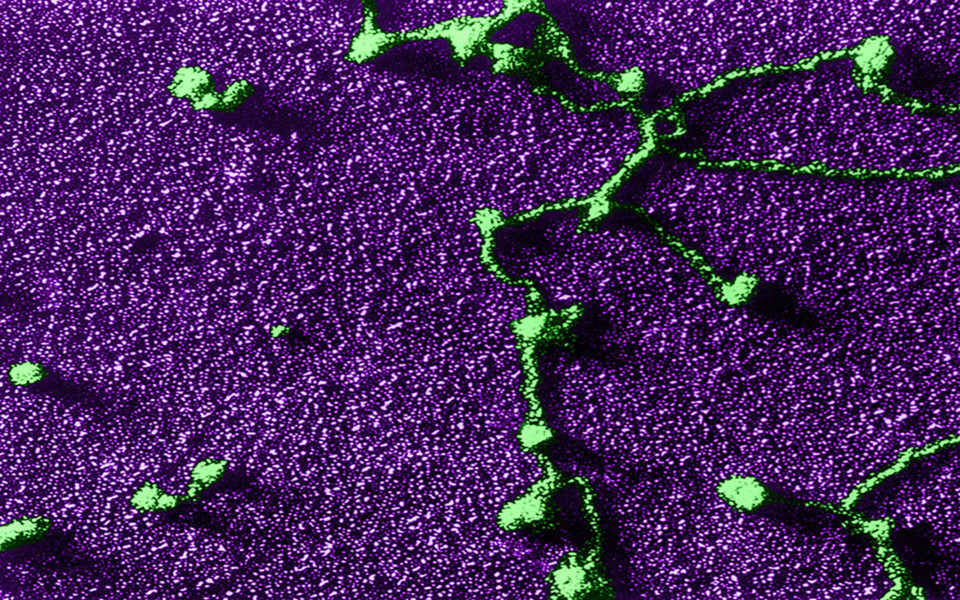 An electron micrograph of RNA polymerase molecules attached to DNA strands. A newly discovered form of Crispr may eventually be used to modify human RNA.