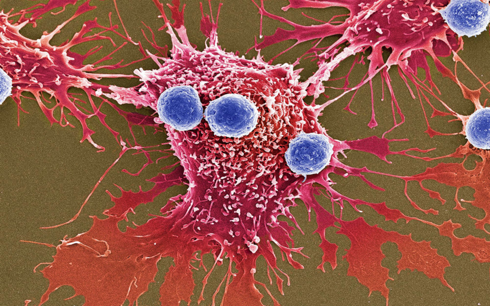 Image of T-cell attached to cancer cell