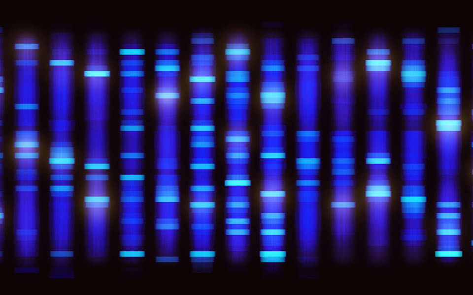 Image of electrophoresis DNA