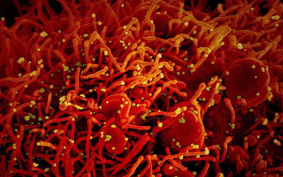 Image of a dying cell infected with coronavirus particles
