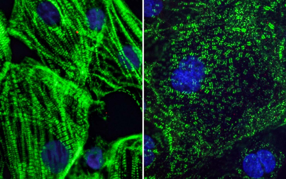 Image of healthy heart muscle cells and SARS-CoV-2 infected heart cells with fragmented sarcomeres