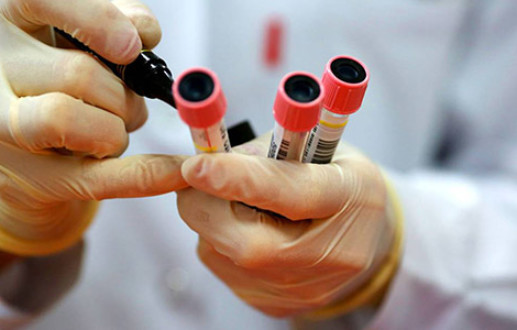 Image of antibody tests