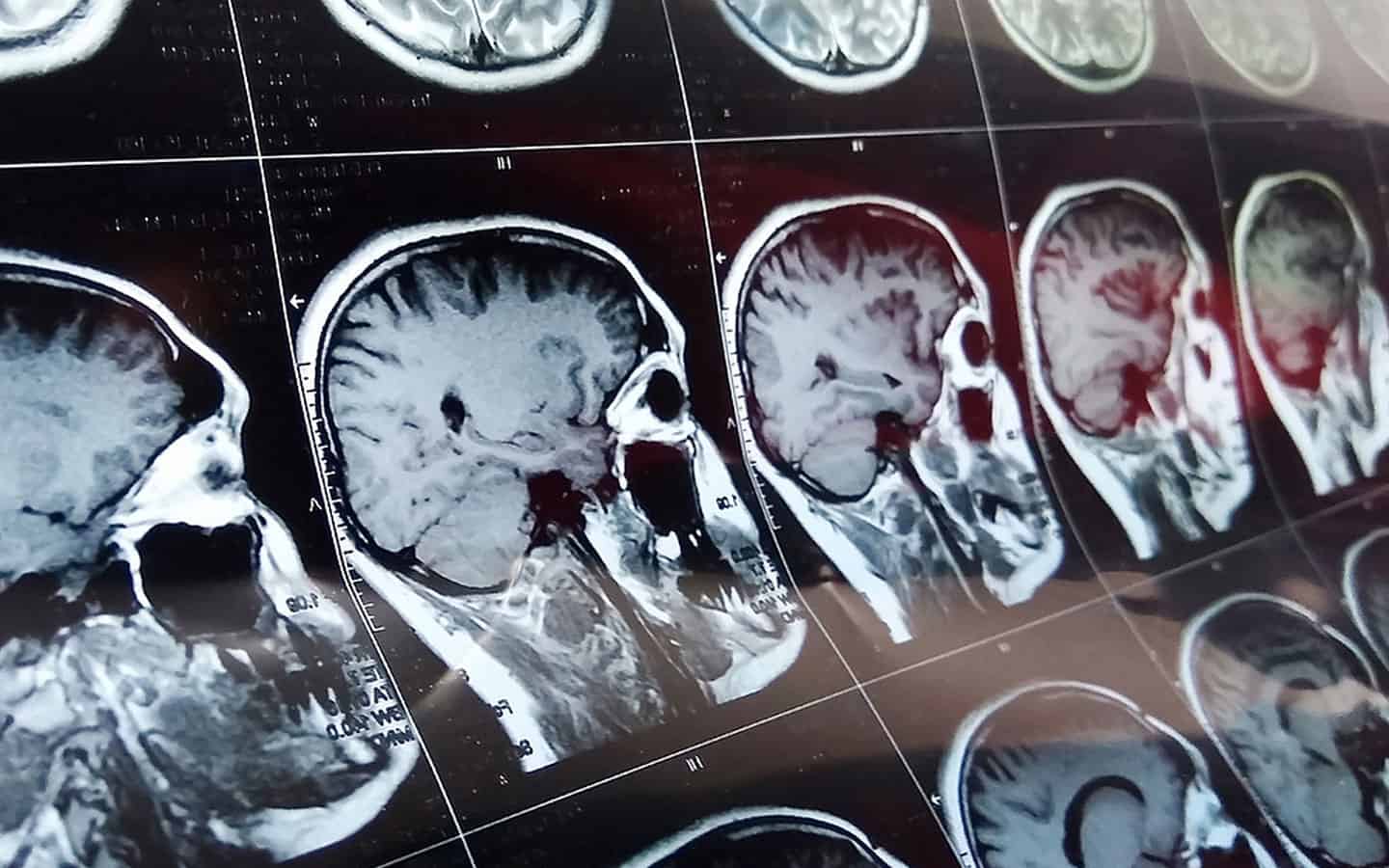 Q Bio unveils 'digital twin' wholebody imaging platform, with Kaiser